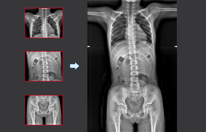 Perfox 3000 Classic-2